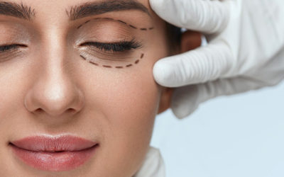 La blépharoplastie : la solution aux paupières tombantes